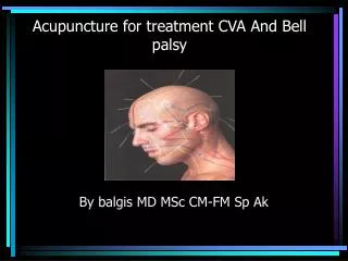Acupuncture for treatment CVA And Bell palsy