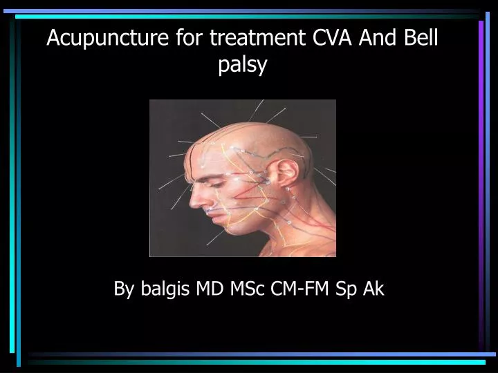 acupuncture for treatment cva and bell palsy