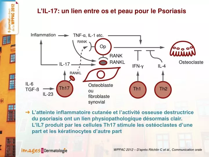 l il 17 un lien entre os et peau pour le psoriasis