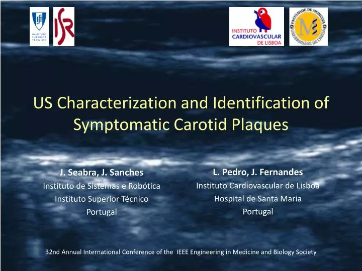 us characterization and identification of symptomatic carotid plaques