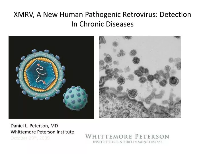 xmrv a new human pathogenic retrovirus detection in chronic diseases