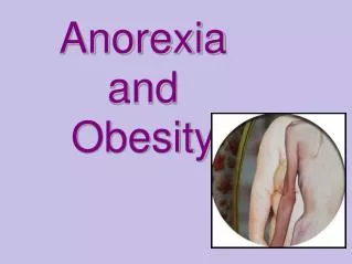 Anorexia and Obesity