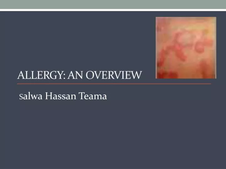 allergy an overview