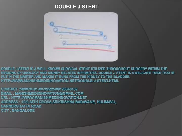 double j stent