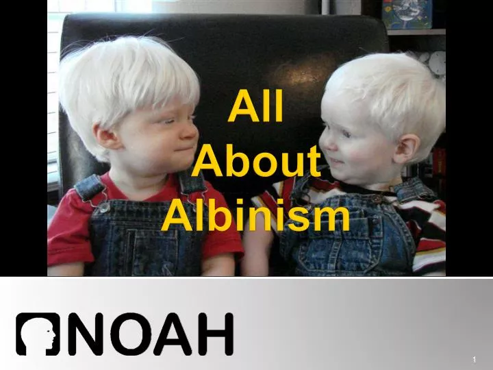all about albinism