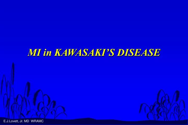 mi in kawasaki s disease