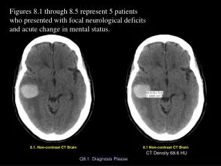 8.1. Non-contrast CT Brain