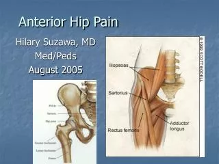 Anterior Hip Pain
