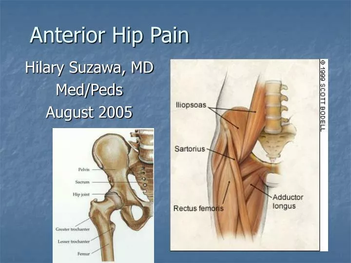 anterior hip pain