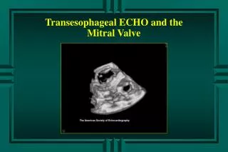 Transesophageal ECHO and the Mitral Valve