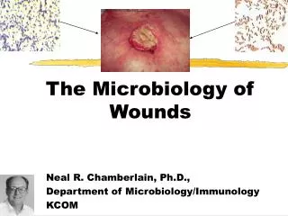 The Microbiology of Wounds