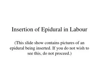 Insertion of Epidural in Labour (This slide show contains pictures of an epidural being inserted. If you do not wish to