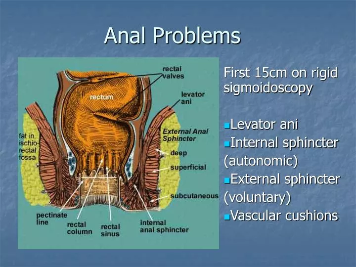 anal problems
