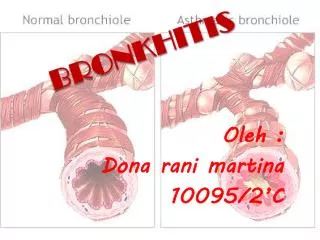 bronkhitis