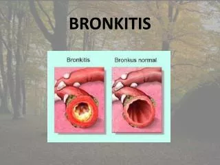 Bronkhitis