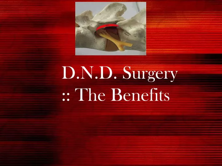 d n d surgery the benefits