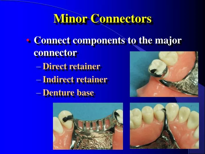 minor connectors