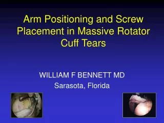 Arm Positioning and Screw Placement in Massive Rotator Cuff Tears