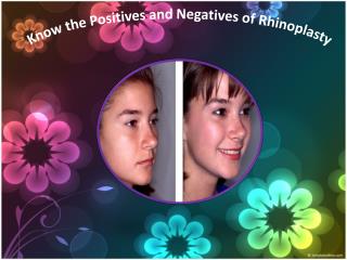 Know the Positives and Negatives of Rhinoplasty