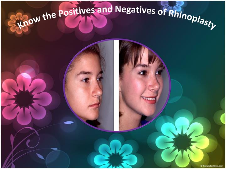 know the positives and negatives of rhinoplasty