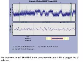Are these seizures? The EEG is not conclusive but the CFM is suggestive of seizures