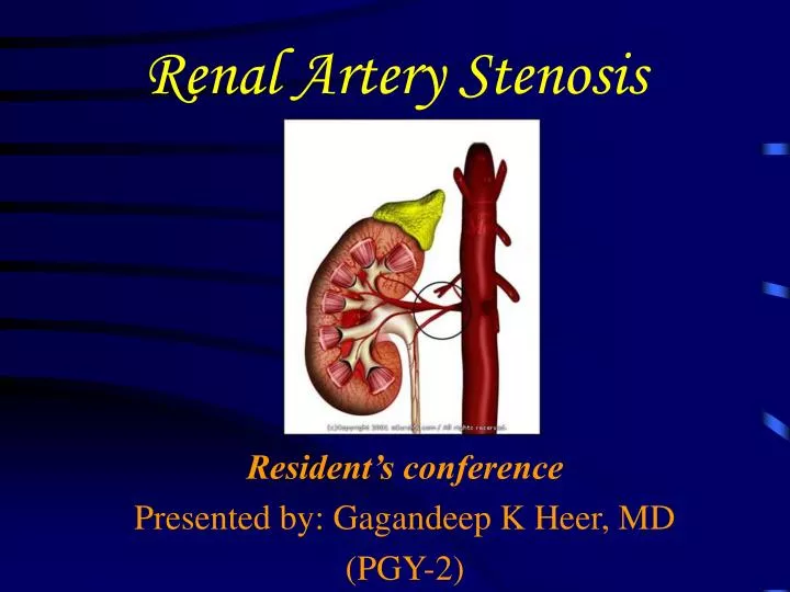 renal artery stenosis