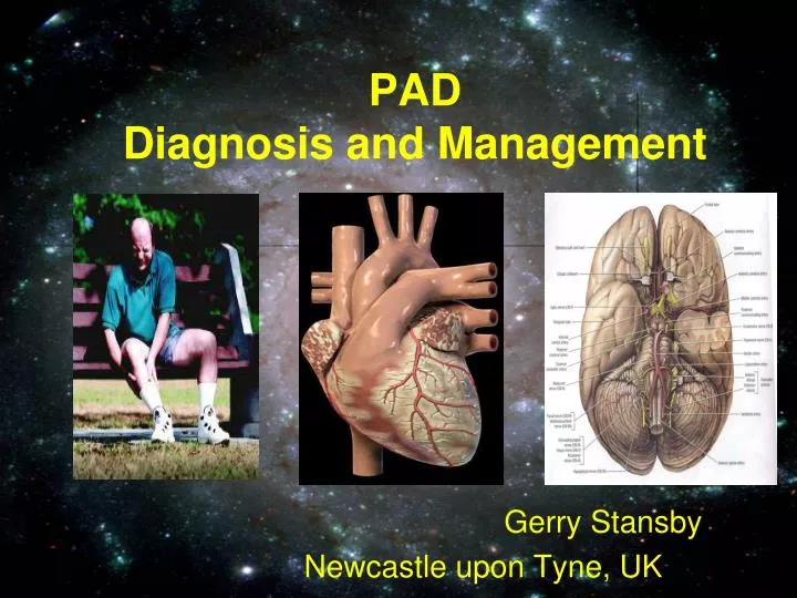 pad diagnosis and management