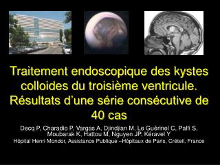 Traitement endoscopique des kystes colloides du troisième ventricule. Résultats d’une série consécutive de 40 cas