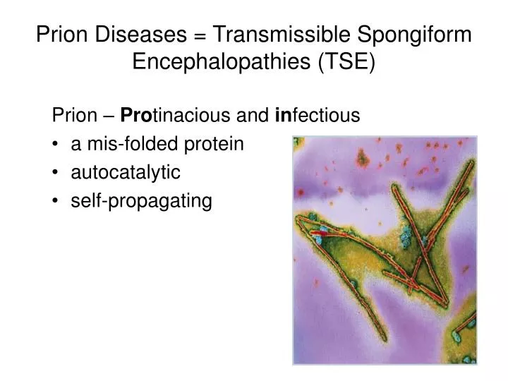 prion diseases transmissible spongiform encephalopathies tse