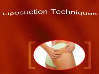 Liposuction Techniques