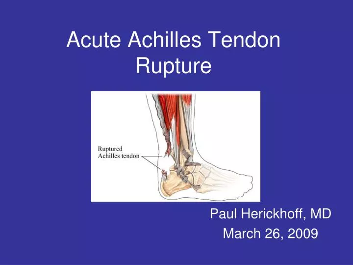 acute achilles tendon rupture