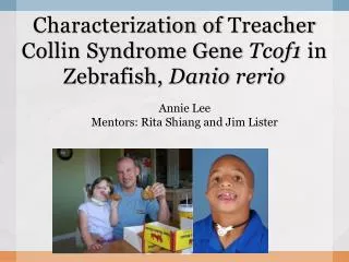 Characterization of Treacher Collin Syndrome Gene Tcof1 in Zebrafish , Danio rerio