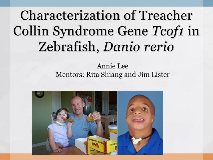 characterization of treacher collin syndrome gene tcof1 in zebrafish danio rerio