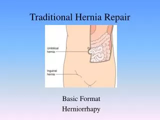 Traditional Hernia Repair
