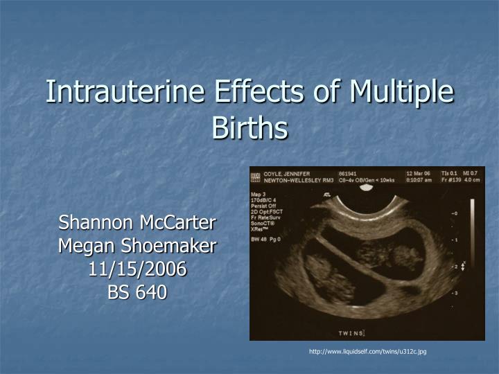 intrauterine effects of multiple births