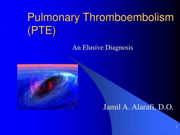 pulmonary thromboembolism pte