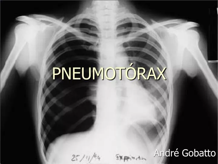 pneumot rax