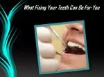What Fixing Your Teeth Can Do For You