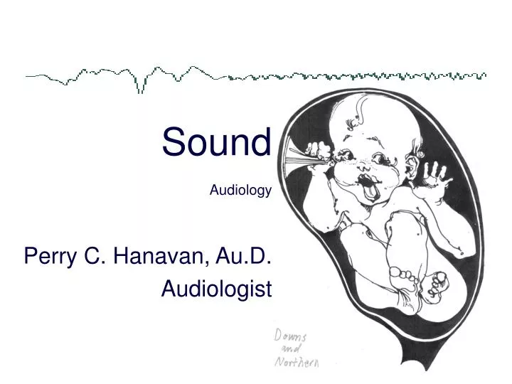 sound audiology