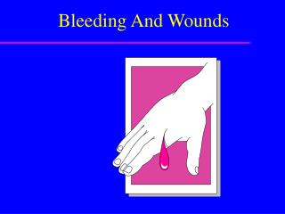 Bleeding And Wounds