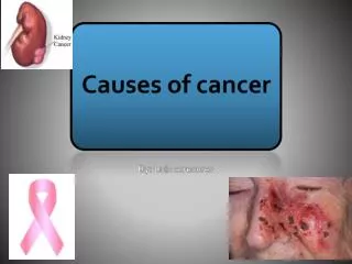 causes of cancer luis c.