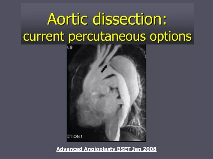 aortic dissection current percutaneous options
