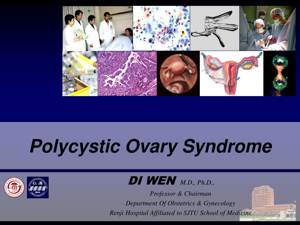PPT - Polycystic Ovary Syndrome PowerPoint Presentation, free download ...