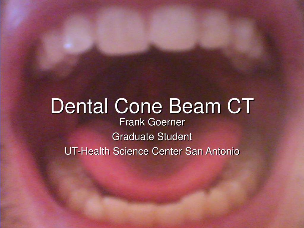 PPT - Dental Cone Beam CT PowerPoint Presentation, free download - ID ...