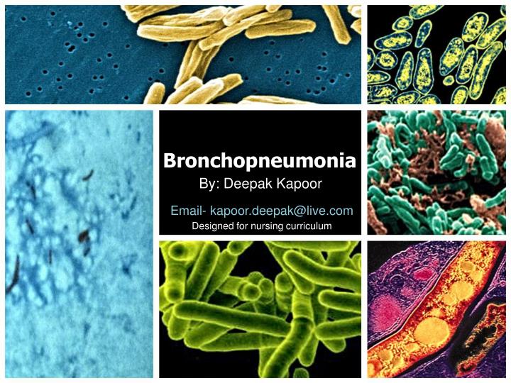 bronchopneumonia