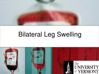 Bilateral Leg Swelling
