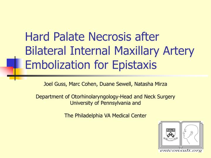 hard palate necrosis after bilateral internal maxillary artery embolization for epistaxis