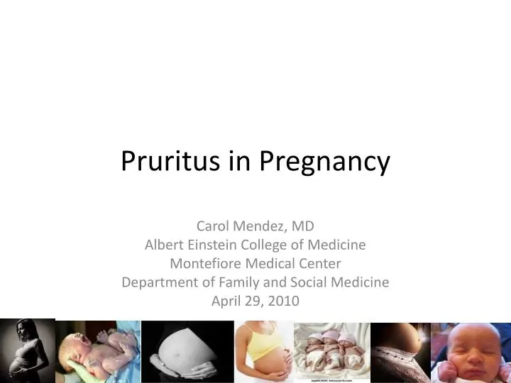 pruritus in pregnancy