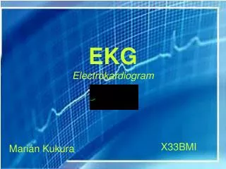 EKG Electrokardiogram