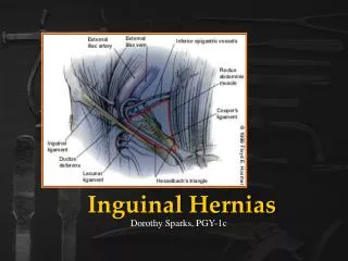 Inguinal Hernias